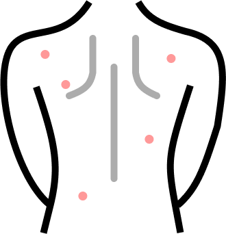 Injury.png